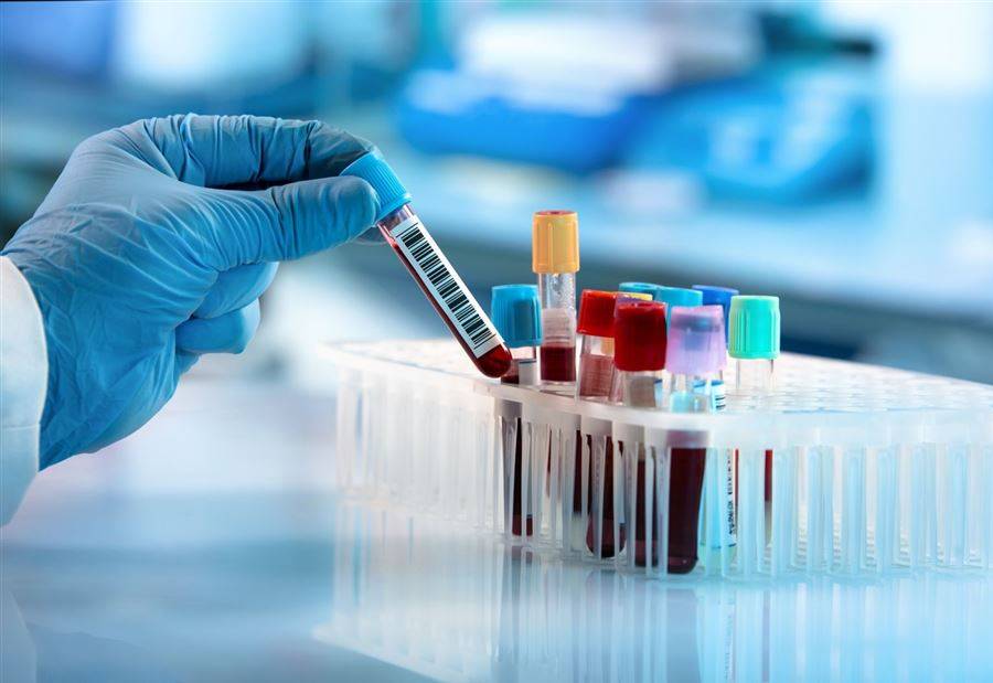 هذا ما أظهرته نتائج الـPCR  لـ 214  شخصاً في مزبود!