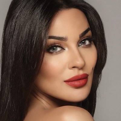 نادين نجيم تتعرض لكسر في يدها خلال تصوير 