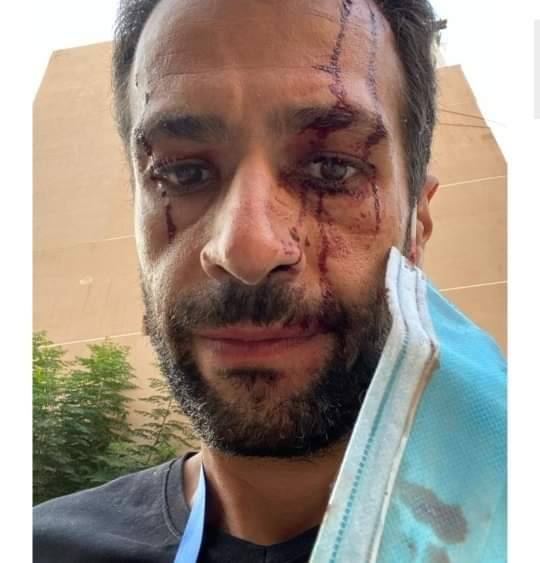 إصابة مالك مكتبي في انفجار مرفأ بيروت