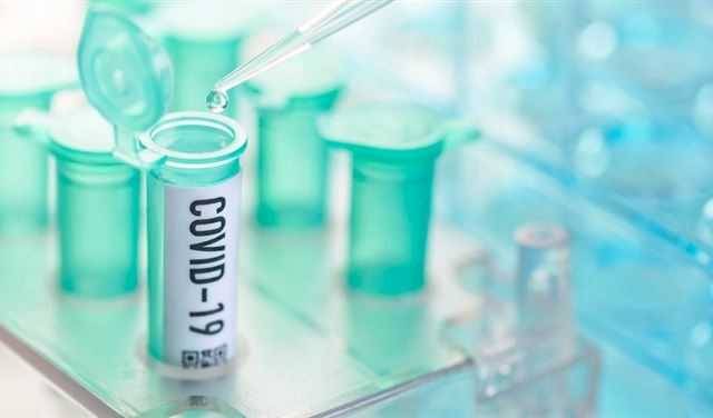 الكورة تسجّل 83 إصابة جديدة بـ