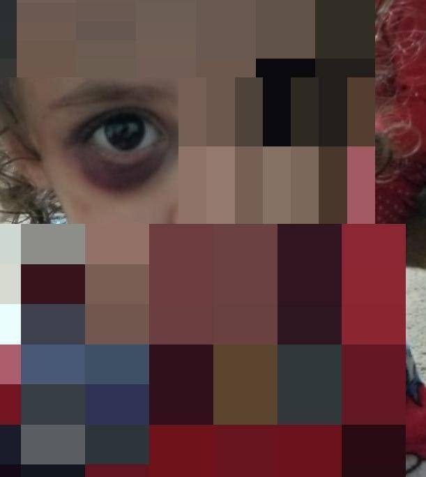 طفلة تتعرّض لـ