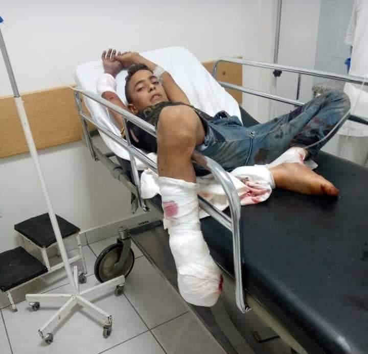 إصابة طفل بإنفجار لغم أرضي في وادي خالد