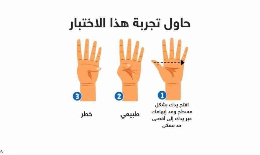 بحركة اليد.. فحص 
