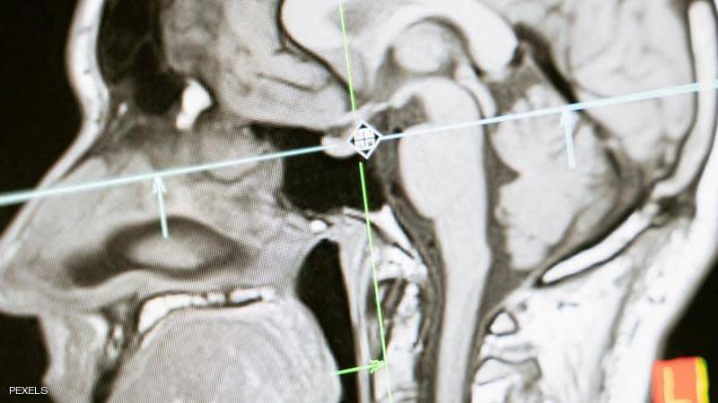 مرض 