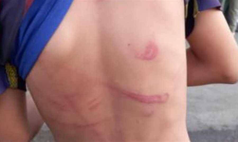 أب يعنّف ابنه بآلة حادّة!
