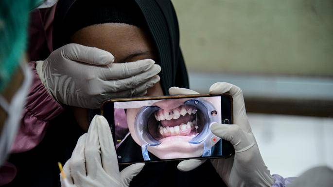أمراض الفم تصيب 3.5 مليارات شخص!
