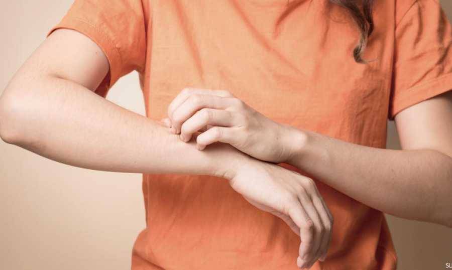 حكة الجلد والتقدم في العمر.. 4 نصائح طبية لتفادي الأسوأ