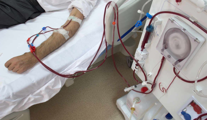 تعديل تعرفة جلسة غسيل الكلى للمرة الخامسة