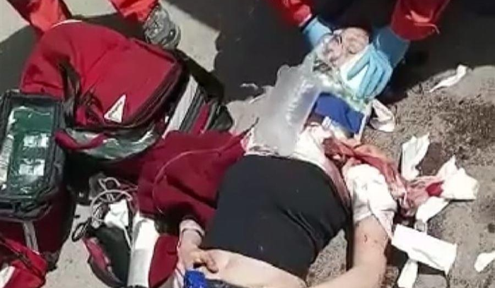 الكلاب الشاردة تنقض على شابة في إهدن.. وهذا ما حصل!