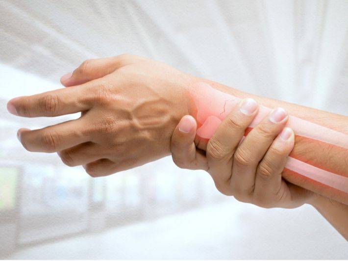 هشاشة العظام قد تصيب مليار شخص بحلول 2050