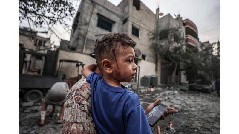 وزارة الصحة الفلسطينية بغزة: ارتفاع عدد الشهداء بالقطاع إلى 560 والجرحى إلى 2900 بسبب القصف الإسرائيلي