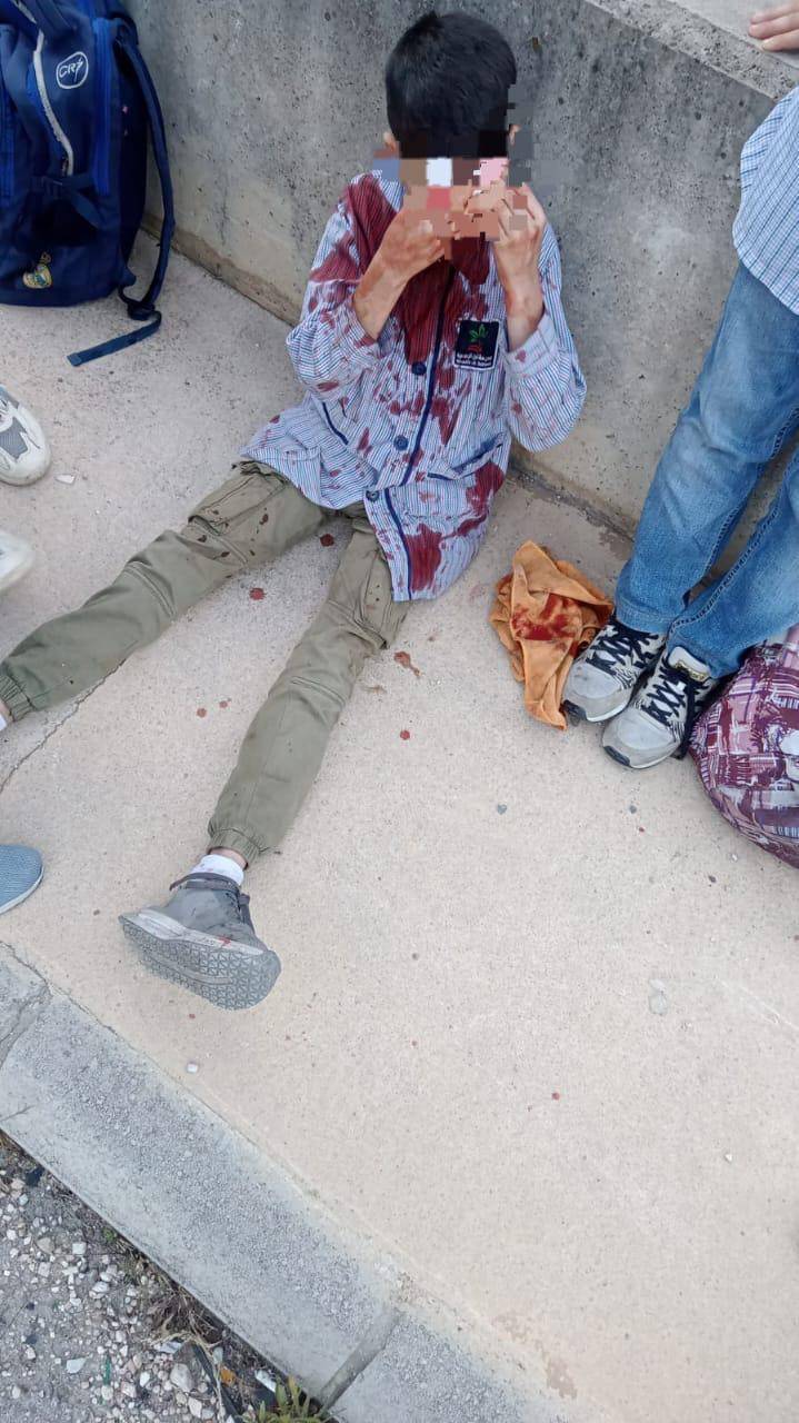 شهيدان في غارة قرب النبطية