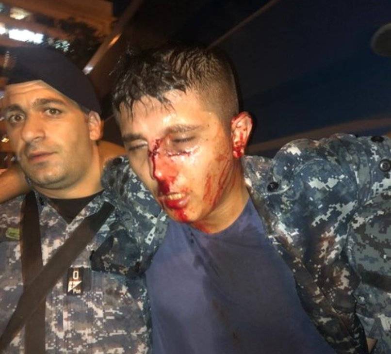 ‏24 جريحا من قوى الأمن أثناء قيامهم بحفظ الأمن ‏