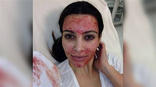 دعوى كيم كاردشيان ضدّ طبيب تجميل... وهكذا ردّ الأخير !