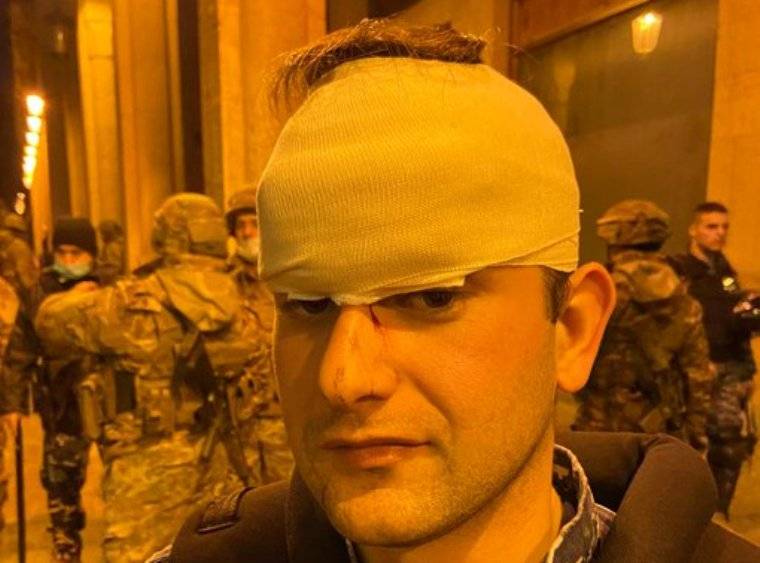 بالصور.. إصابات في صفوف ‏عناصر قوى الأمن عولج بعضهم ميدانيا والبعض الآخر نقل الى ‏المستشفيات